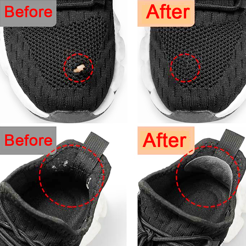 Sports Shoes Patches Vamp Repa - Sneaker Care Accessories 리뷰 및 가격