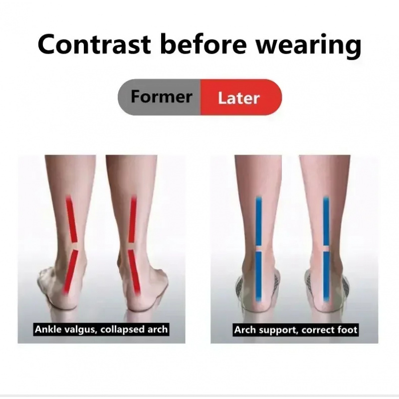 2 Pcs EVA Flat Feet Arch Suppo - Sneaker Care Accessories 리뷰 및 가격